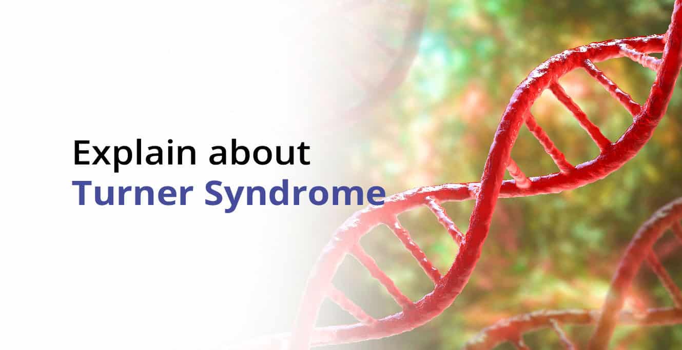 टर्नर सिंड्रोम क्या है? लक्षण, कारण और उपचार – Turner Syndrome in Hindi