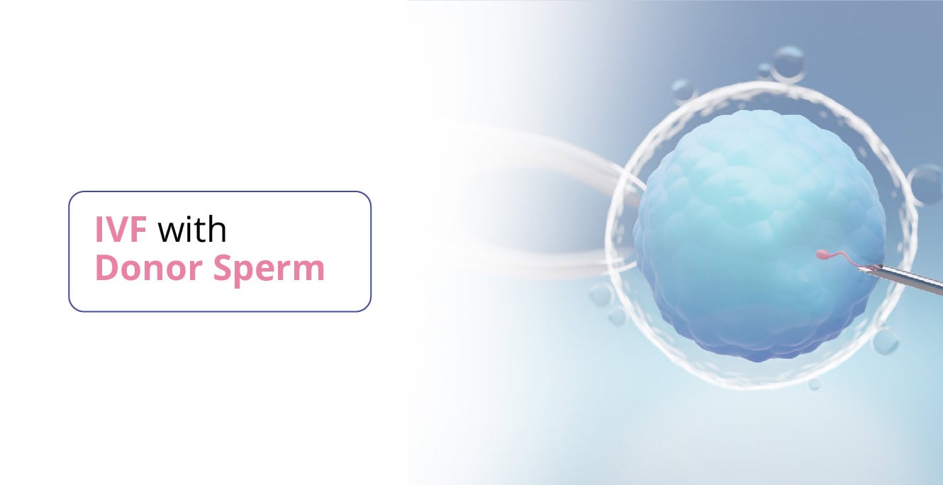 डोनर स्पर्म के साथ आईवीएफ: क्या उम्मीद करें और यह कैसे काम करता है