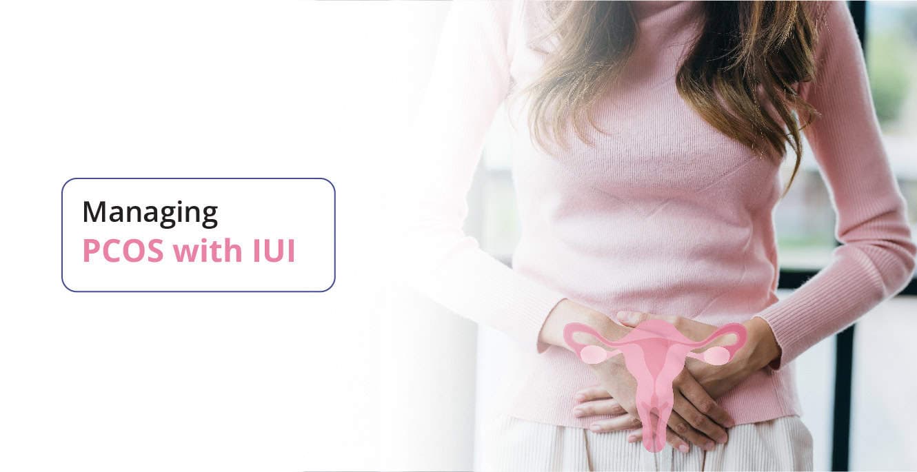 पीसीओएस (Polycystic Ovary Syndrome) और प्रजनन क्षमता पर उसका असर