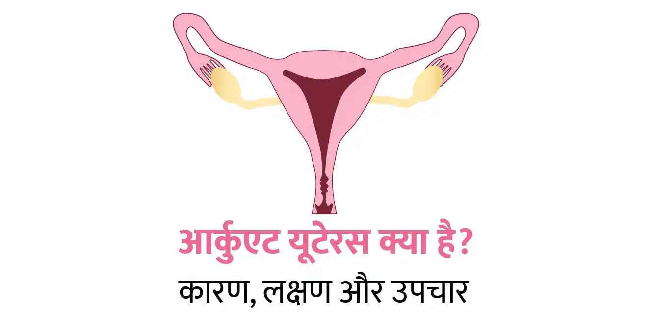 Arcuate Uterus in Hindi – आर्कुएट यूटेरस क्या है? कारण, लक्षण और उपचार