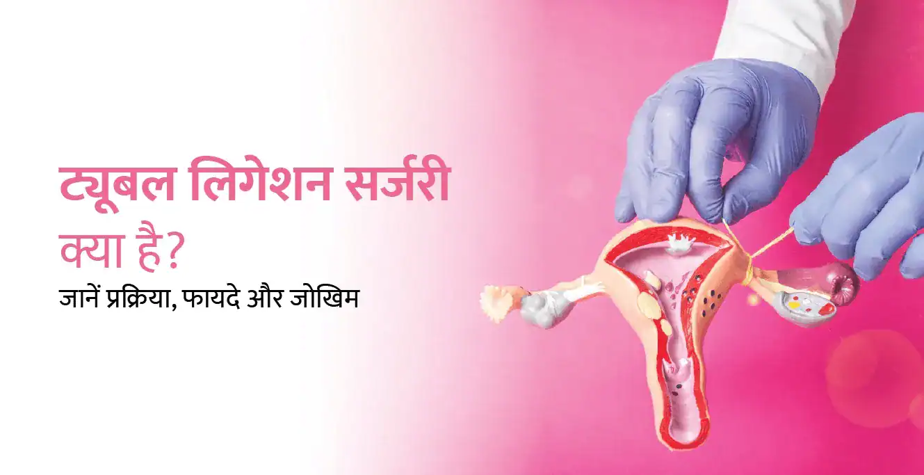 Tubal Ligation Meaning in Hindi – ट्यूबल लिगेशन सर्जरी क्या है? जानें प्रक्रिया, फायदे और जोखिम