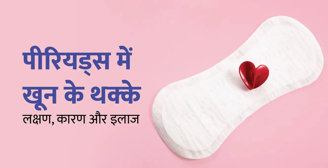 पीरियड्स में खून के थक्के(Menstrual Clots): लक्षण, कारण और इलाज