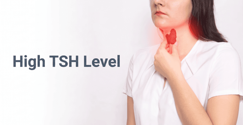 What Is Considered a Dangerously High TSH Level?