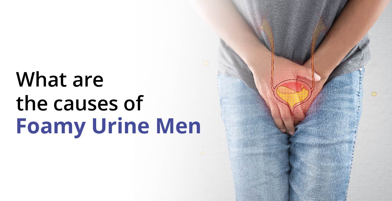 Foamy Urine in Men: Symptoms, Causes, Diagnosis & Treatment