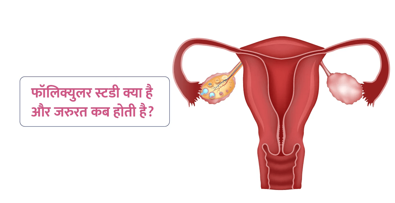 फॉलिक्युलर स्टडी क्या है और ज़रूरत कब होती है?