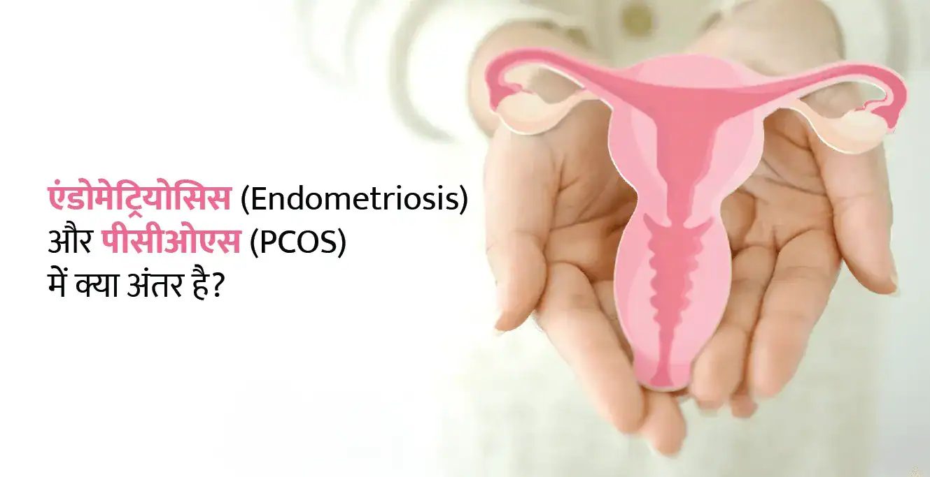 एंडोमेट्रियोसिस (Endometriosis) और पीसीओएस (PCOS) में क्या अंतर है?