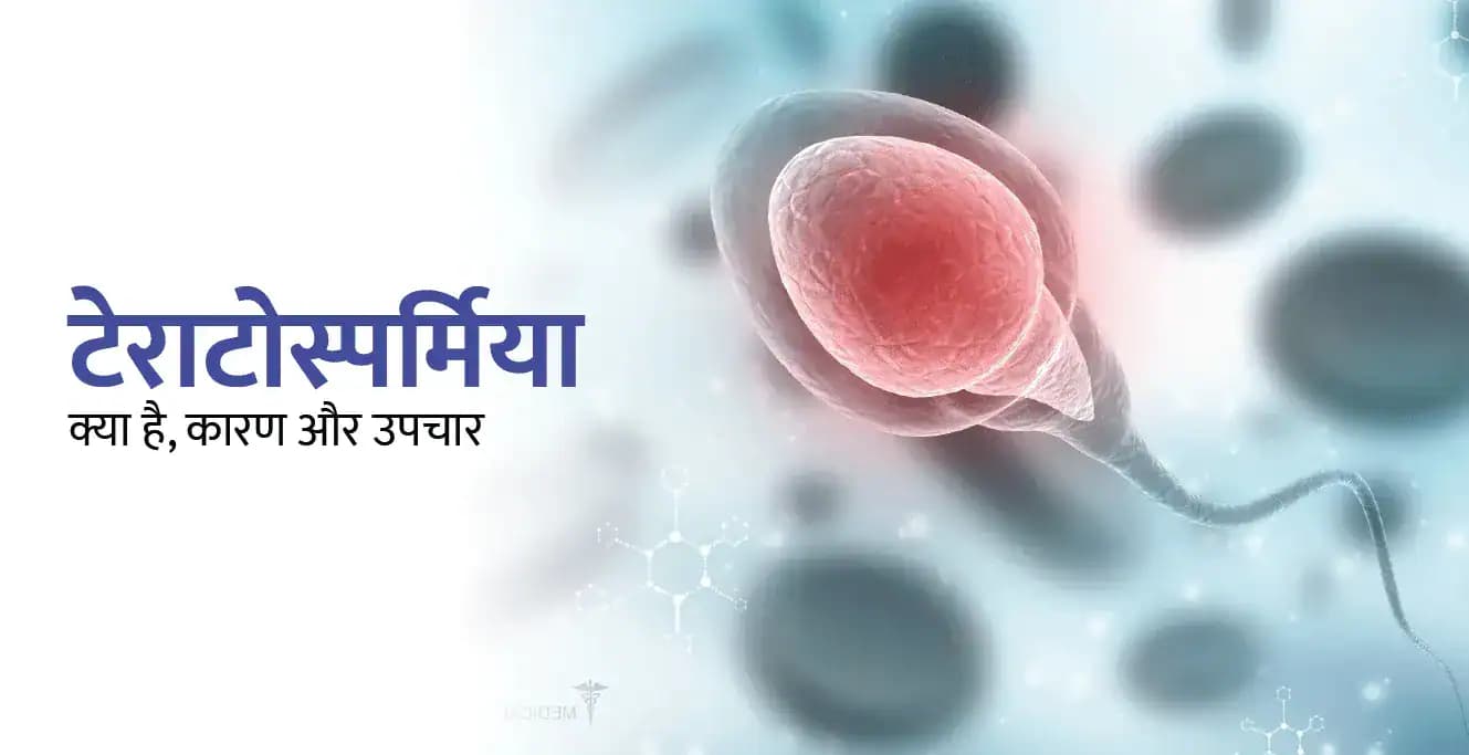 टेराटोस्पर्मिया क्या है, कारण, उपचार और निदान