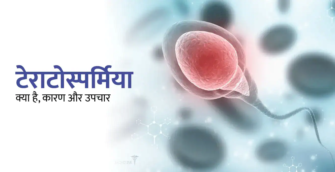 टेराटोस्पर्मिया क्या है, कारण, उपचार और निदान