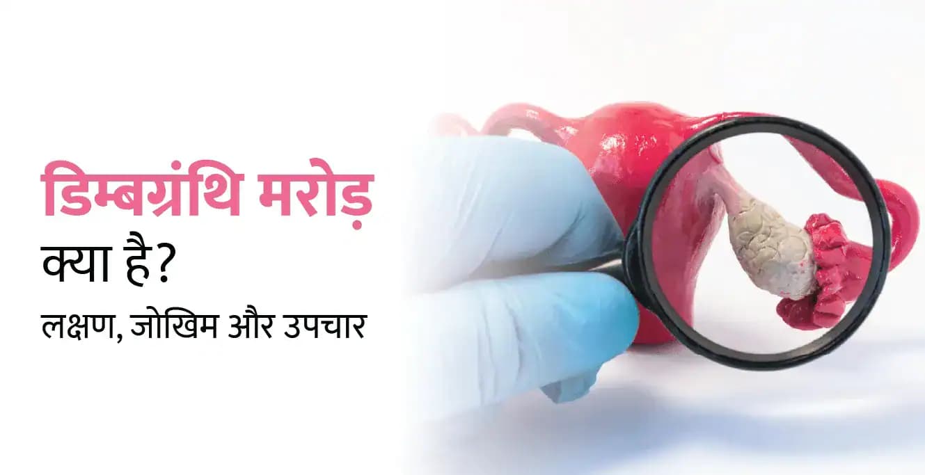 Ovarian Torsion in Hindi: डिम्बग्रंथि मरोड़ क्या है? लक्षण, जोखिम और उपचार