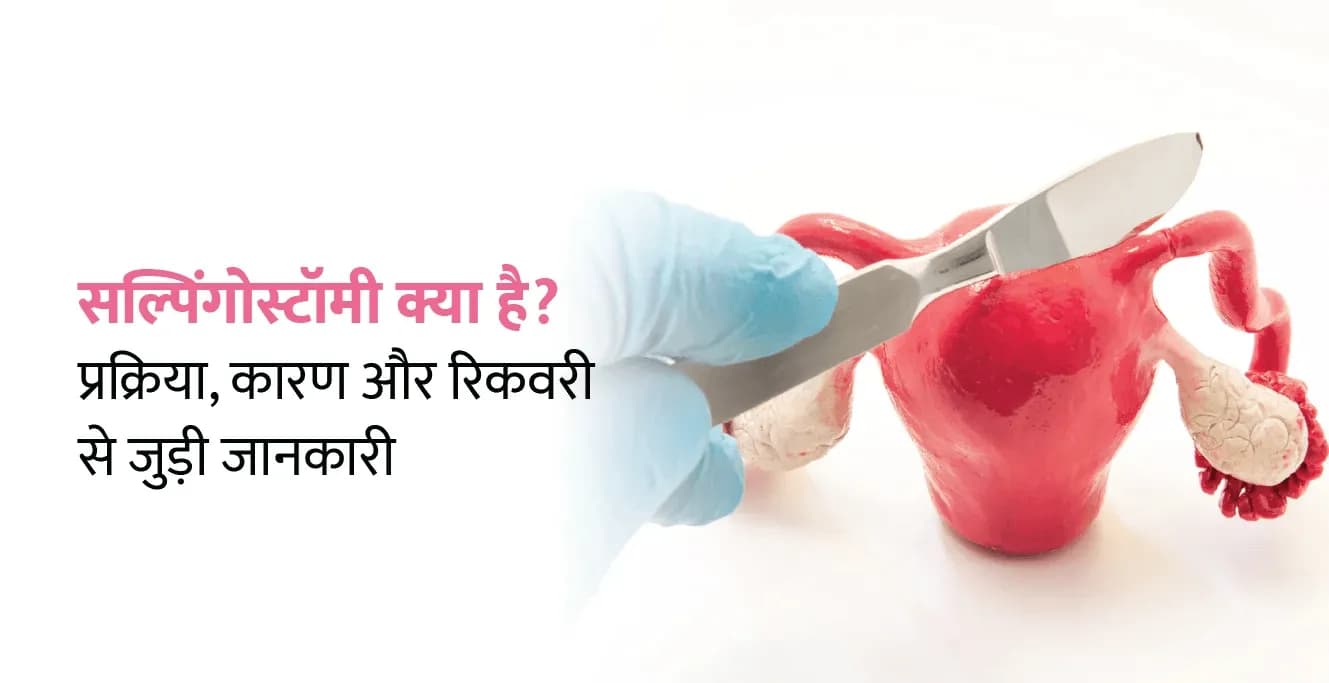 सैल्पिंगोस्टॉमी क्या है? प्रक्रिया, कारण और रिकवरी से जुड़ी जानकारी