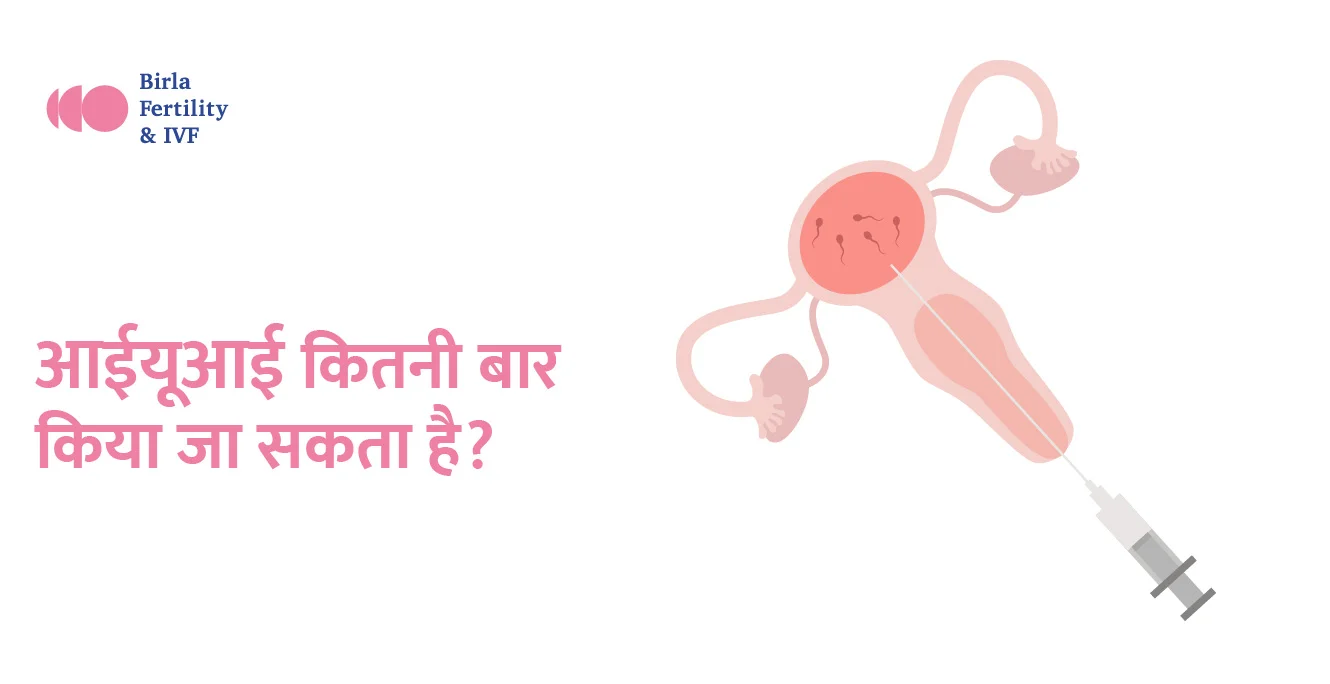 IUI कितनी बार हो सकता है और आगे बढ़ने से पहले कितनी बार IUI करवाना चाहिए?