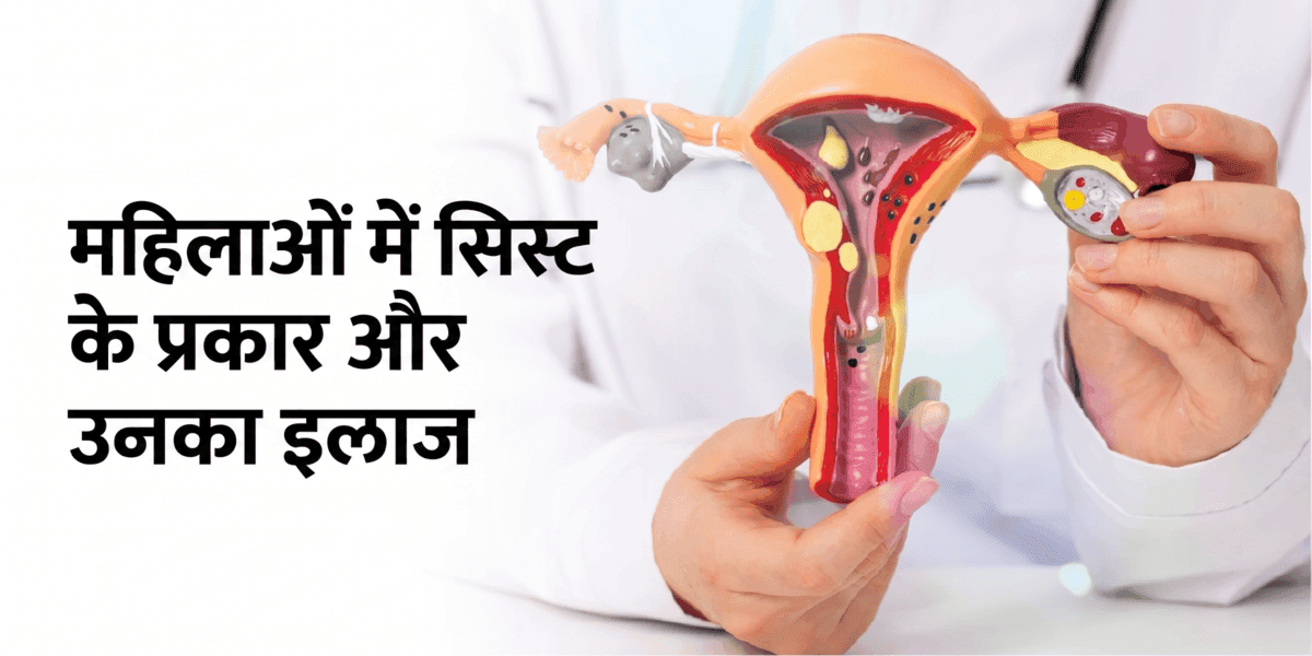 महिलाओं में सिस्ट के प्रकार और उनका इलाज: कारण, लक्षण और कब चिंता करें