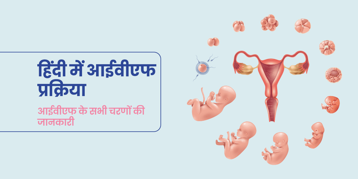 IVF कैसे किया जाता है? IVF की पूरी टाइमलाइन और स्टेप-बाय-स्टेप प्रोसेस