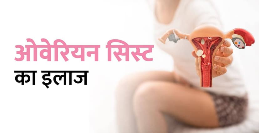 ओवरी में गांठ का घरेलू इलाज – Ovarian Cyst Treatment in Hindi
